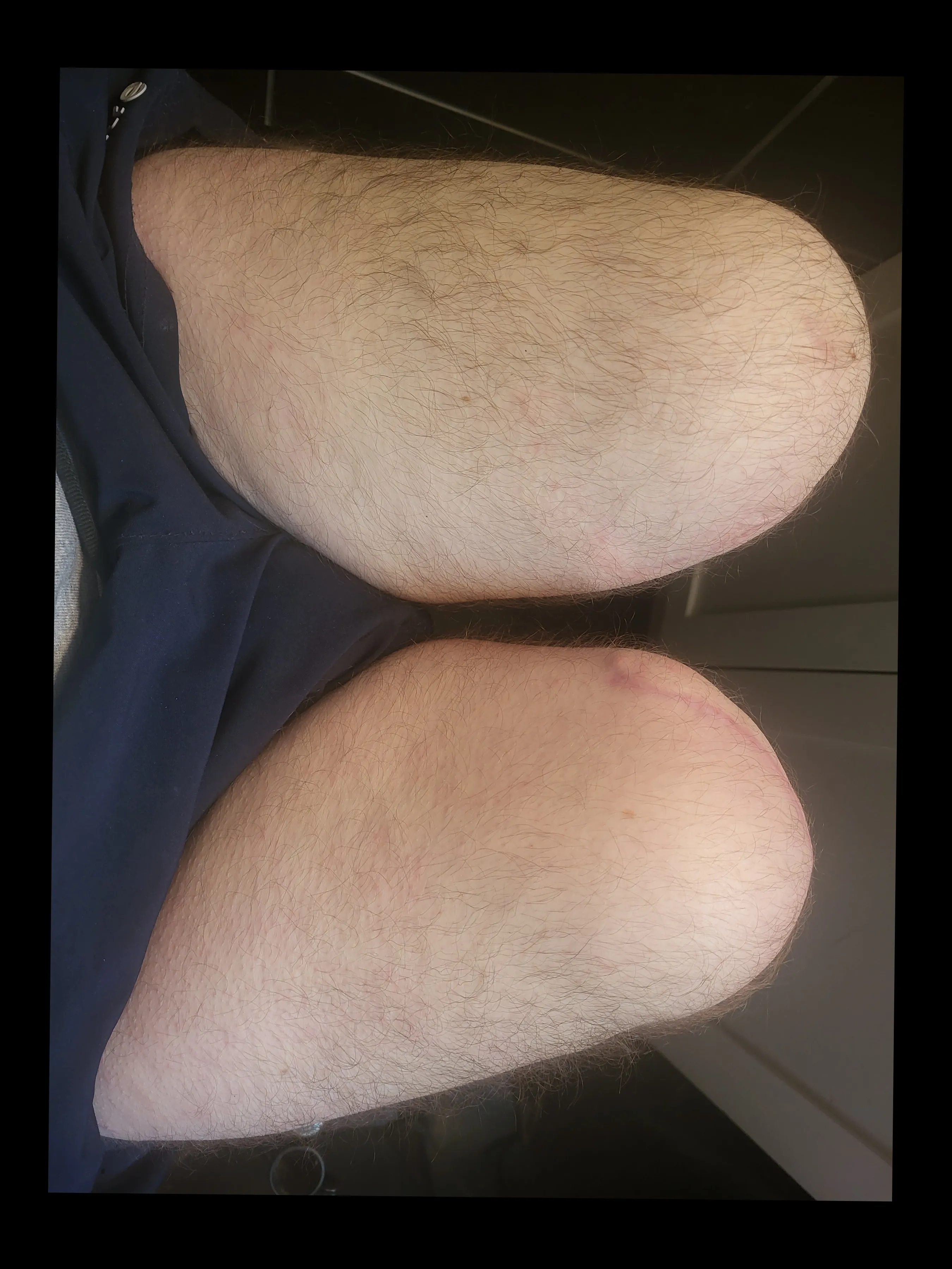 Bilateral Bo OnlyFans leaked - bilateralbo nude pics and videos free