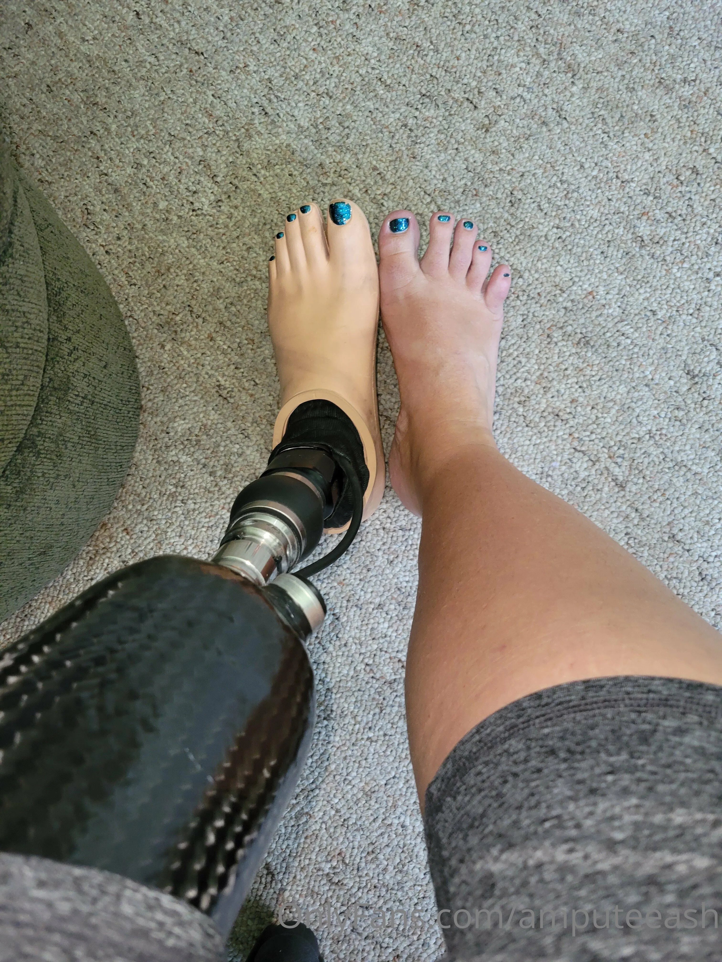 AmputeeAsh OnlyFans leaked nude photo 2 - amputeeash naked pics free download