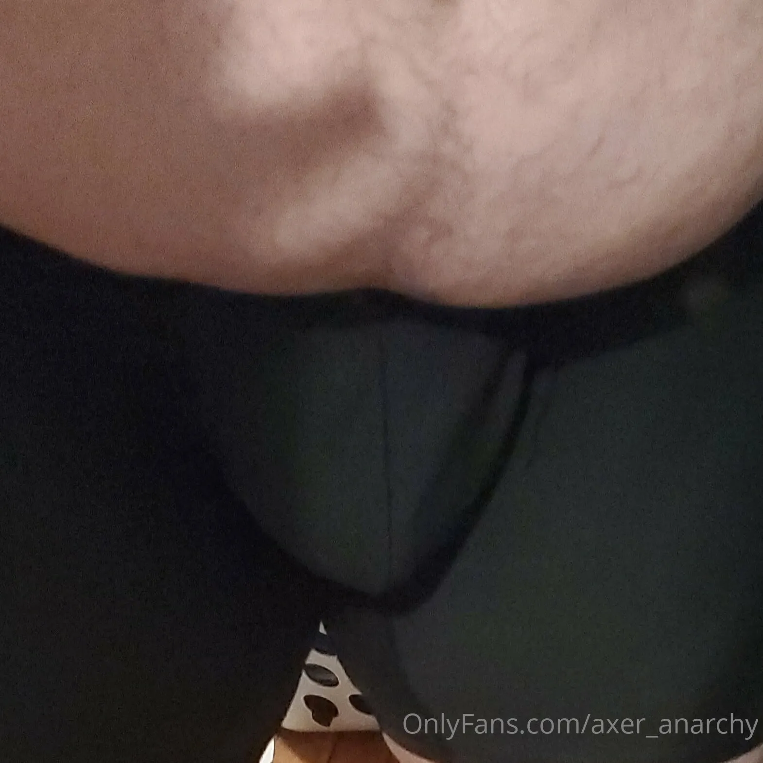 Axer OnlyFans leaked nude photo 22 - axer_anarchy naked pics free download