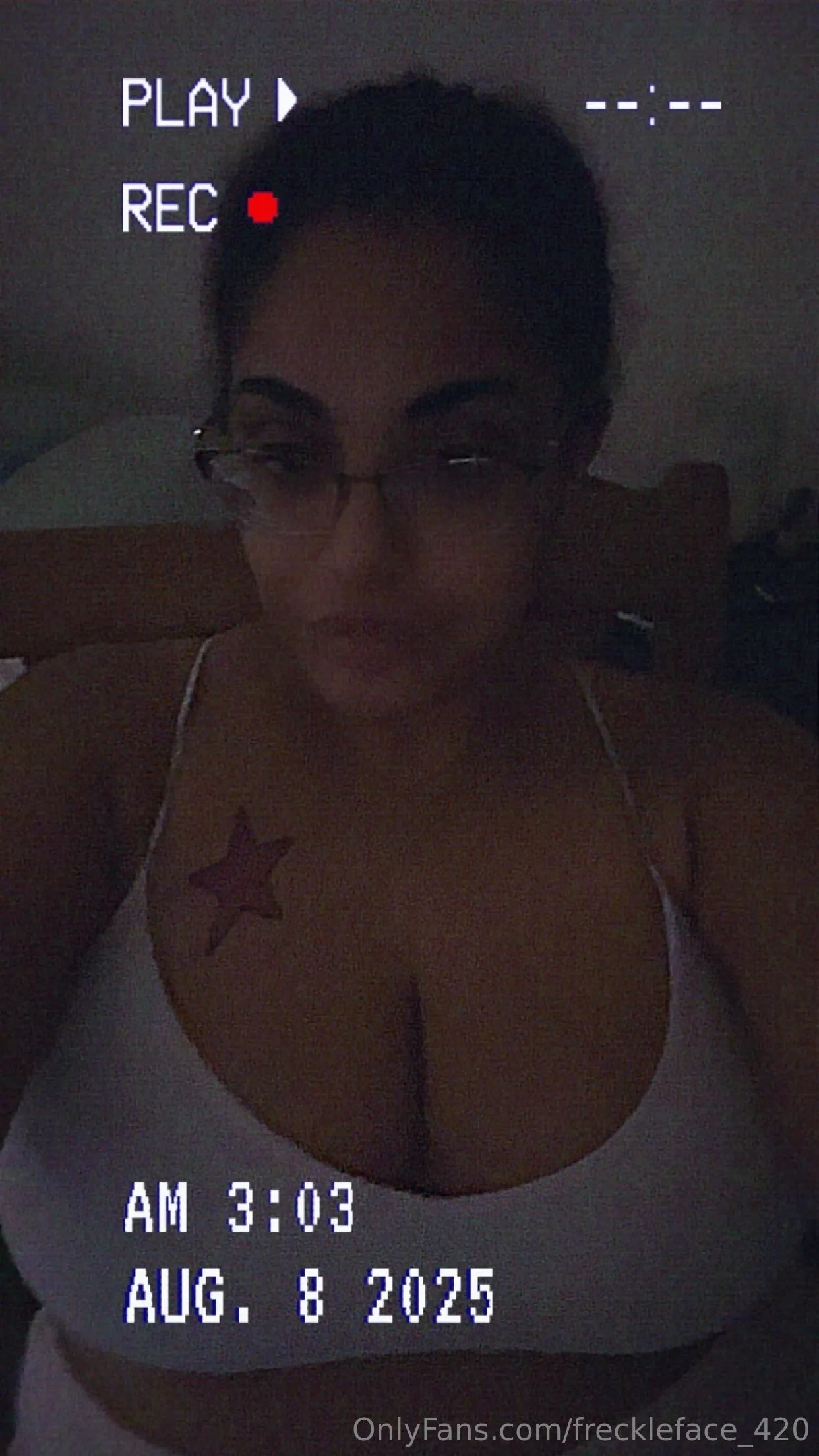 Alexmo OnlyFans leaked nude photo 11 - freckleface_420 naked pics free download